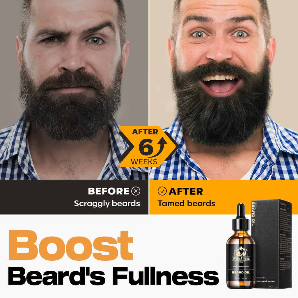 Waking Forest Beard Oil for Men 60 ml - Unscented Biotin Mustache Oil with Vitamin E, Rosemary & Castor - Beard Care Softener, Strengthens, and Moisturizes - Beard Conditioner (2 oz)