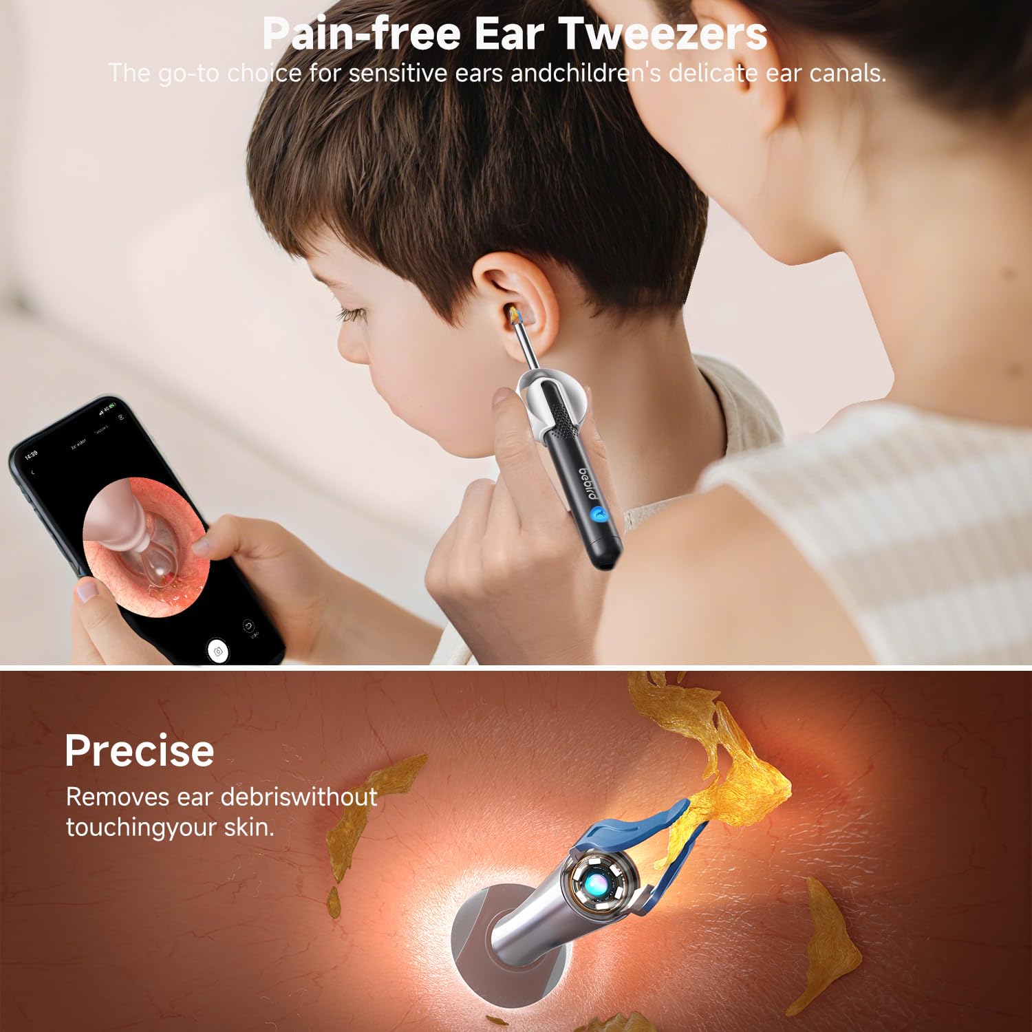 BEBIRD R1 Ultra Ear Wax Remova, Ear Cleaner with Camera Ear Scope, Wax Remove Ear Pick with Ear Otoscope Tweezers, Visual Dropper Cleaning Kit, Ear/Nose/Throat Examination Tool for Family, Black