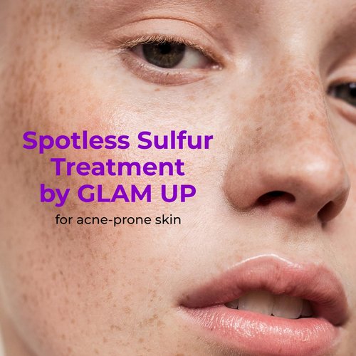GLAM UP 10% Sulfur Treatment Serum - Fast Healing for Pimples & Acne Breakouts | 15mL (0.5 fl. oz.)