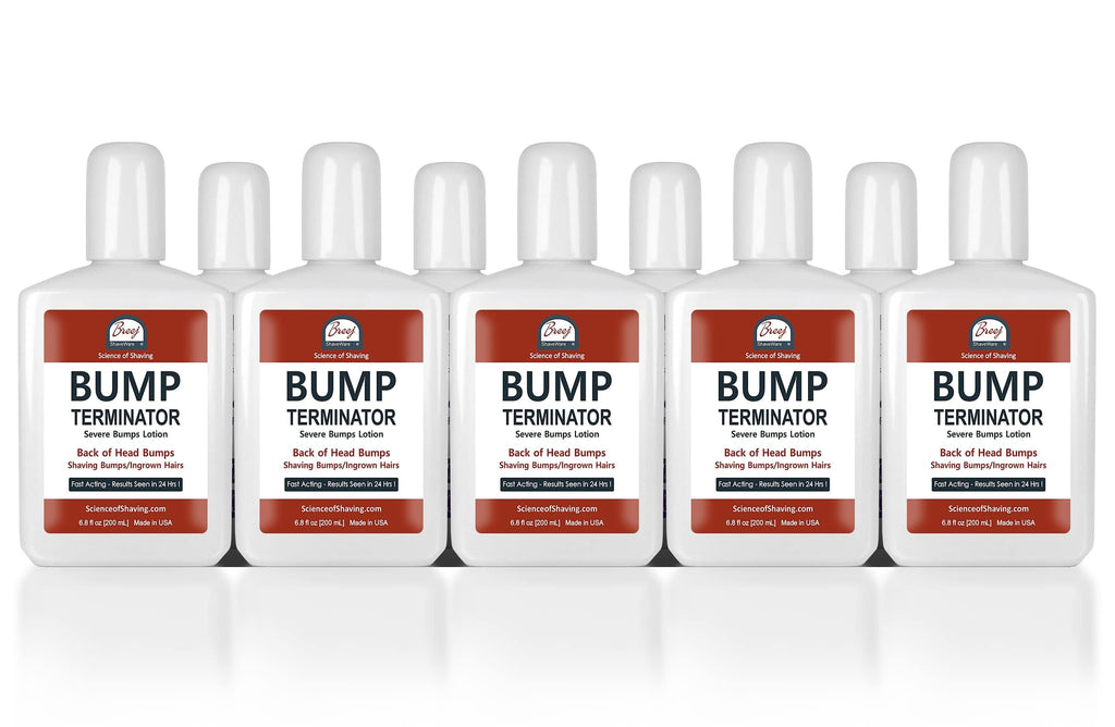 BREEJ BUMP TERMINATOR Severe Bumps Treatment | Razor Bumps And Ingrown Hair Treatment | Razor Bump Treatment, 200 mL