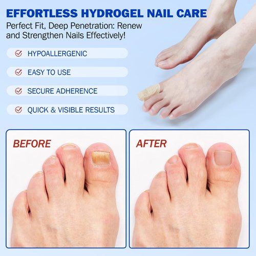 Fungal Nail Patches 42 PCS, Toenail Treatment Extra Strength 8-Hour Overnight Nail Fast Acting Repair Effortless Hydrogel Nail Care and Repair for Damaged Nails Overnight Renewal for Men and Women
