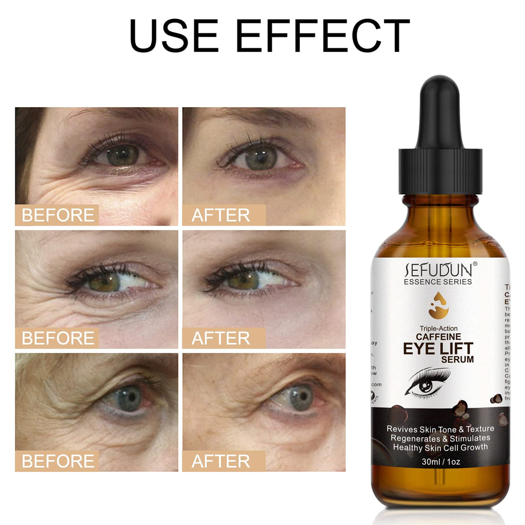 Caffeine Eye Serum, Eye Serum Anti Aging Wrinkles Effectively Fades Dark Circles, Eye Bags, Helping to Minimize Wrinkles and Fine Lines, Eliminate Puffiness, with EGCG, Vitamin C Under Eye Serum 30ml
