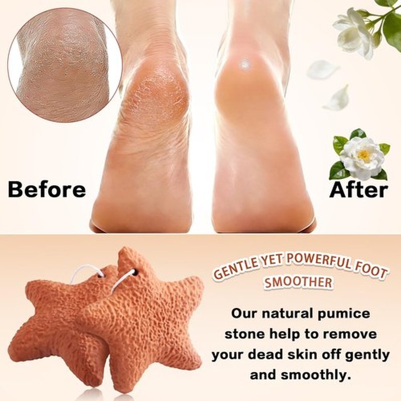 2PCS Natural Terra-Cotta Pumice Stone, Pedicure Tools Hard Skin Callus Remover for Feet and Hands - Foot File Exfoliation to Remove Dead Skin and Callusess