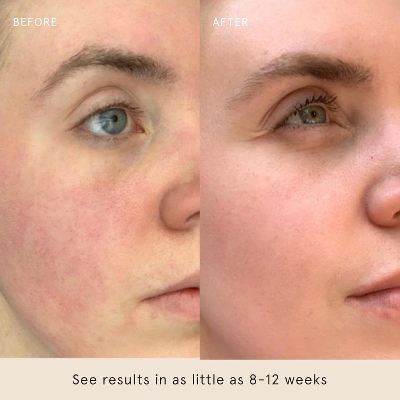 Barefaced Sheer Protection SPF 50+ | Broad-Spectrum Face Sunscreen with Zinc Oxide & Niacinamide - Oil-Free Hydration & Anti-Aging (60ml)