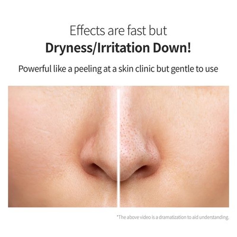 Benton Glycolic Acid 7% Exfoliating Toner with Niacinamide - Gentle AHA Toner for Brighter Skin & Even Tone - Balances Oil & Moisture - Hydrating, Cruelty-Free Korean Skin Care
