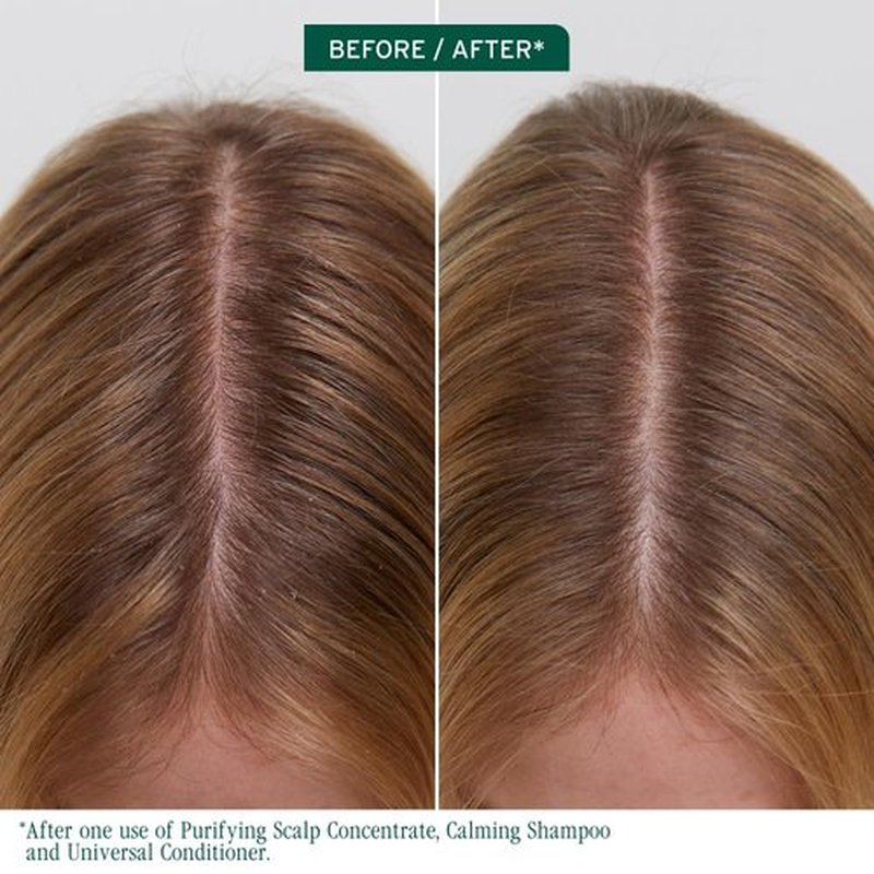 Biolage Scalp Sync Purifying Concentrate - Exfoliating Dry Scalp Treatment with Fermented Tea & Glycolic Acid