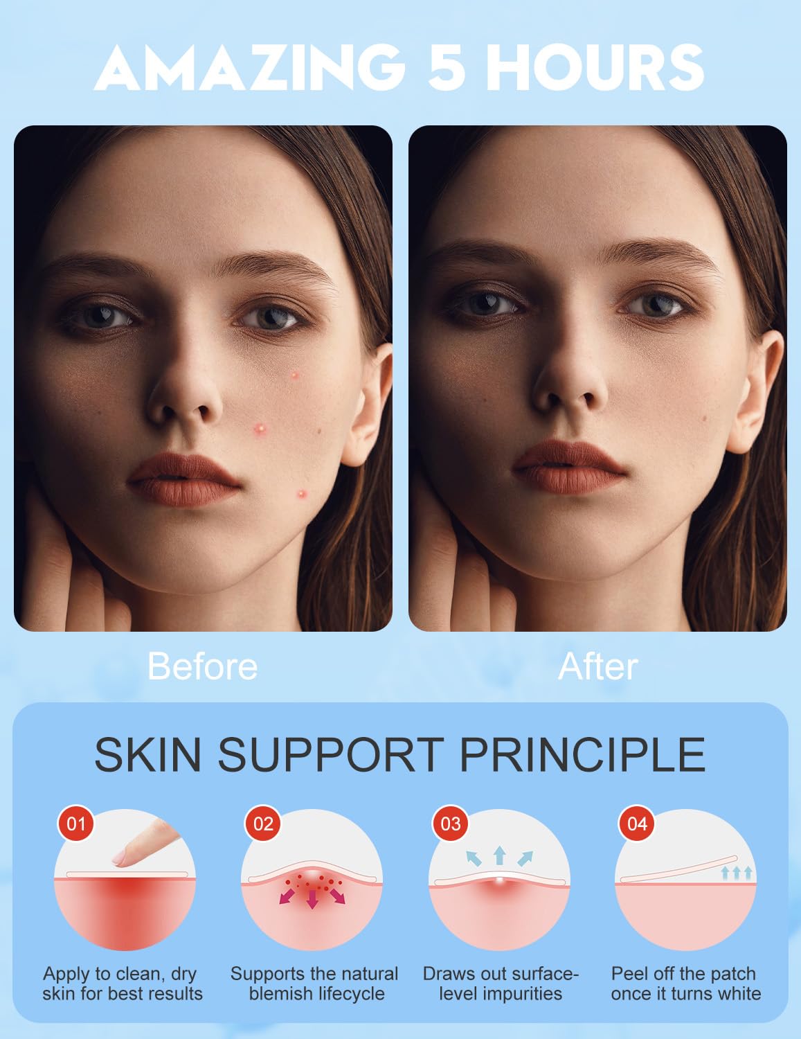Pimple Patches for Face, 7 Sizes, 5 Shape/Color 255 pcs Acne Patches Hydrocolloid Precise Matches Different Sizes Acne, Spot Stickers With Tea Tree Oil Salicylic Acid Centella Covering Zits Blemishes