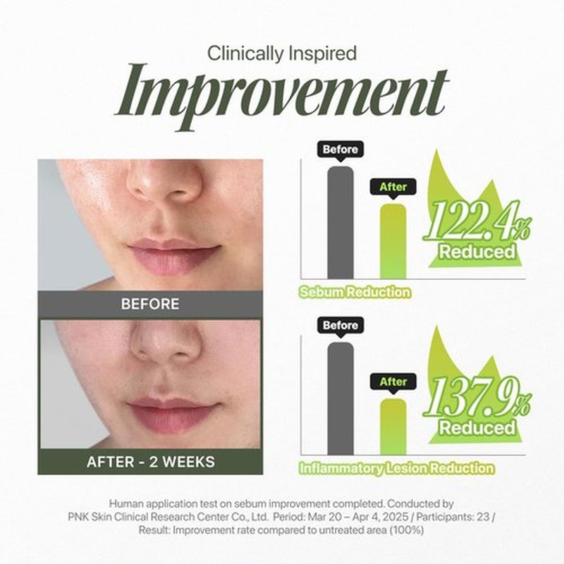 EIOM Trouble Patch Mask – Full Face Pimple Patch – Hydrocolloid Face Mask for Acne-Prone Skin, Covers Multiple Breakout Areas, Absorbs Excess Oil & Buildup (20ml x 4)