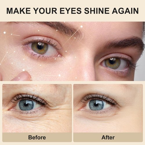 Instant Eye Tightener - Quickly Reduces Dark Circles, Eye Bags, Puffiness and wrinkles, Locks in Moisture