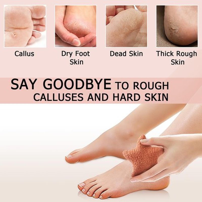 2PCS Natural Terra-Cotta Pumice Stone, Pedicure Tools Hard Skin Callus Remover for Feet and Hands - Foot File Exfoliation to Remove Dead Skin and Callusess