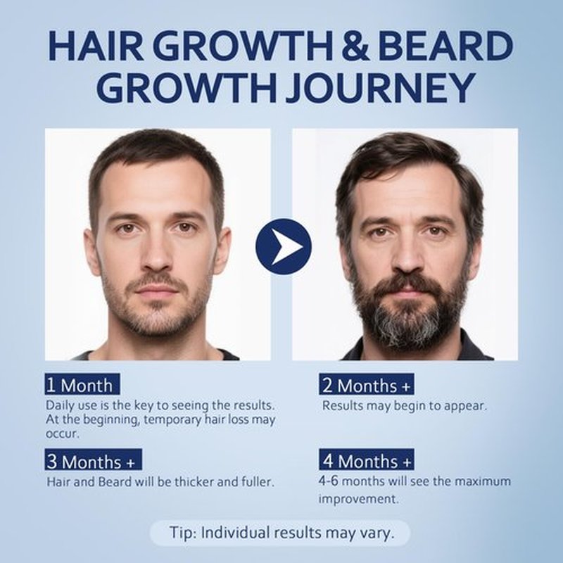 5% Minoxidil Hair Growth Serum for Men & Women with Biotin: Minoxidil for Men and Women, 5 Percent, Hair Regrowth Treatment, Extra Strength, 4 Fluid Ounces (2 Bottles)