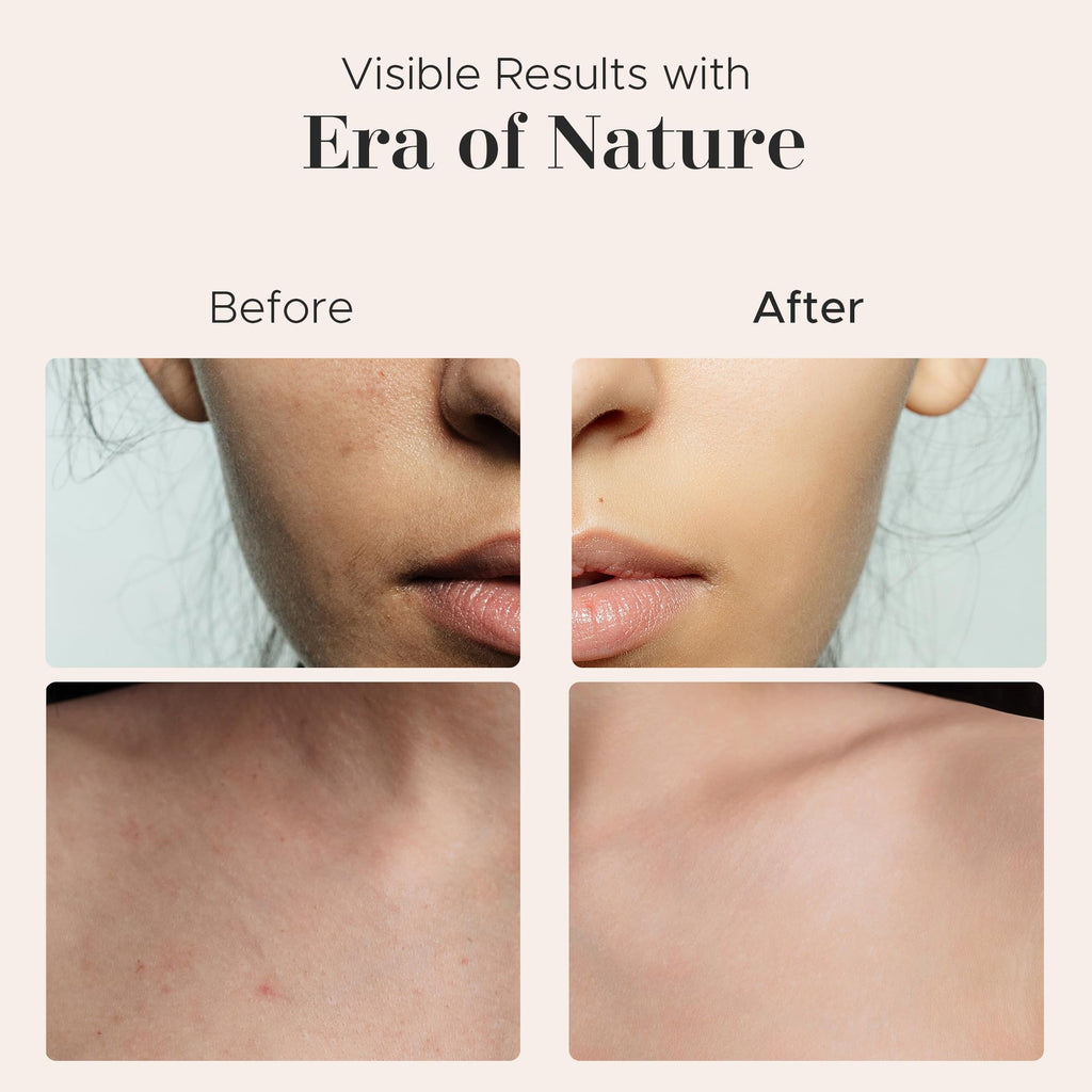 Era of Nature Cocoa Butter Raw – 100% Pure & Unrefined, Cold-Pressed Cacao – For DIY Skincare & Haircare – Deep Hydration for Skin, Hair, Lips – Stretch Mark & Scar Care – Natural Chocolate Scent, 1lb
