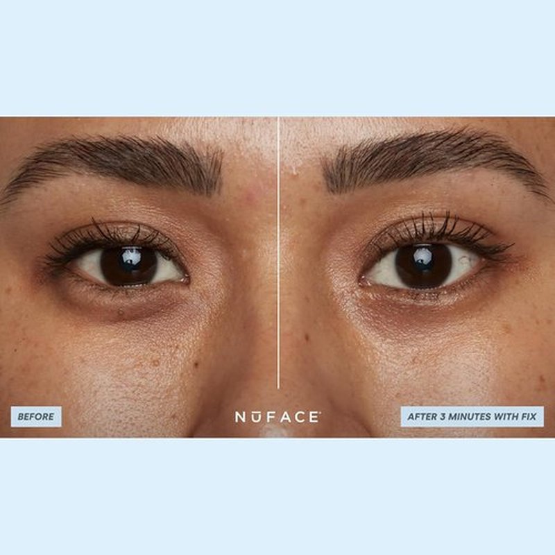 NuFACE IonPlex Hydra-Gel Under Eye Patches - Cooling Treatment for Puffy Eyes & Dark Circles | 60 Count