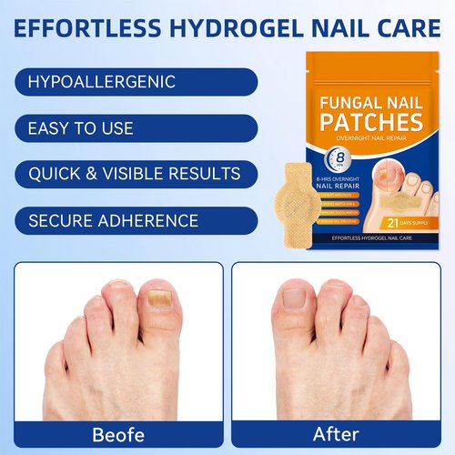 Fungal Nail Patches, Toenail Treatment Extra Strength, 8-Hour Overnight Nail Fast Acting Repair Effortless Hydrogel Nail Care and Repair for Damaged Nails Overnight Renewal 21 Patches