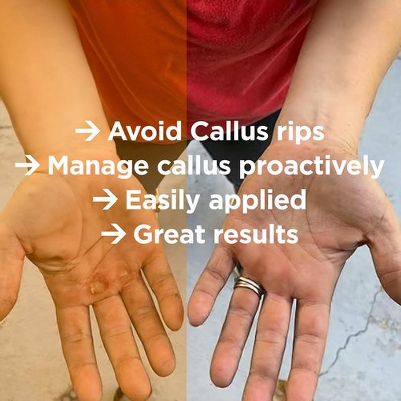 Callus Score – Precision Hand Callus Remover for Athletes | Prevents Ripping | Callus Management for Weightlifters, Cross Training, Gymnastics and More | Callus Performance - we just do calluses