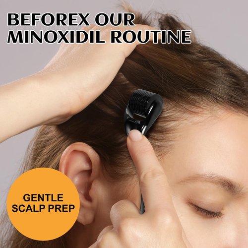 5% Minoxidil Hair Growth, Minoxidil Spray For Beard Growth Serum, Hair Growth oil Spray, Treating Hair Loss For Thicker Longer Fuller Healthier Hair, 3.38 Oz