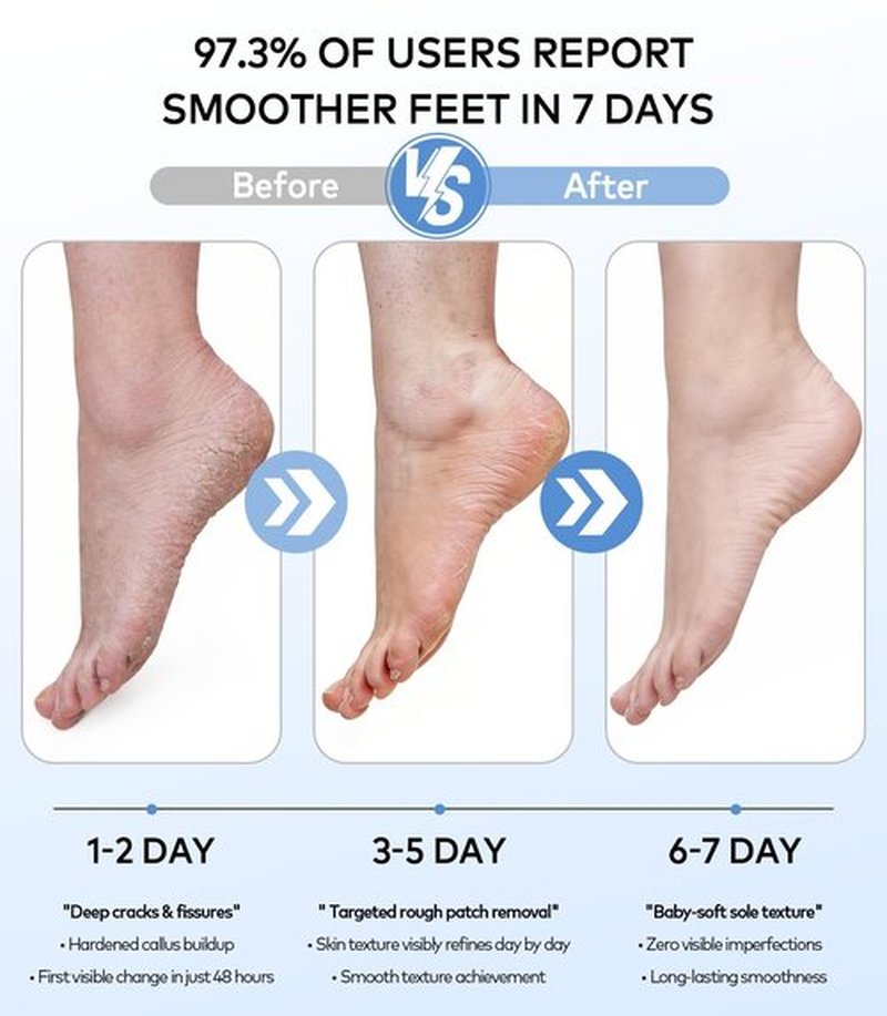 Rechargeable Electric Callus Remover for Feet with Vacuum, Pumice Stone Foot File for 100% Full Foot Care Coverage, 2-Speed & 3 Grinding Heads, Ideal Gift for Dead, Hard Cracked Dry Skin, Black