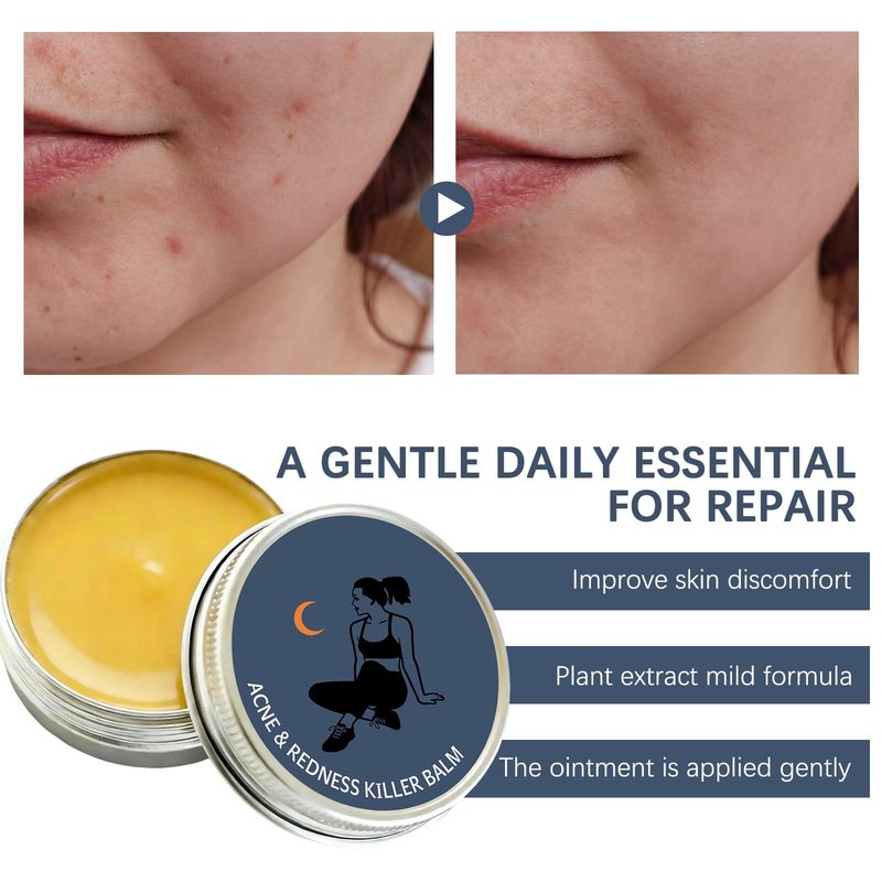 2pcs Acne & Redness Killer, Organics Acne Balm, Remove Skin Care Set Natural Plant Formula For All Skin Types
