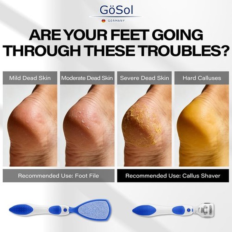 GöSol Foot Callus Remover Set, Durable Foot File and Foot Scrubber with 10Pcs Replacement Slices Blades, Callus Remover for Feet Callus Shaver Hard Dead Skin Pedicure Tools