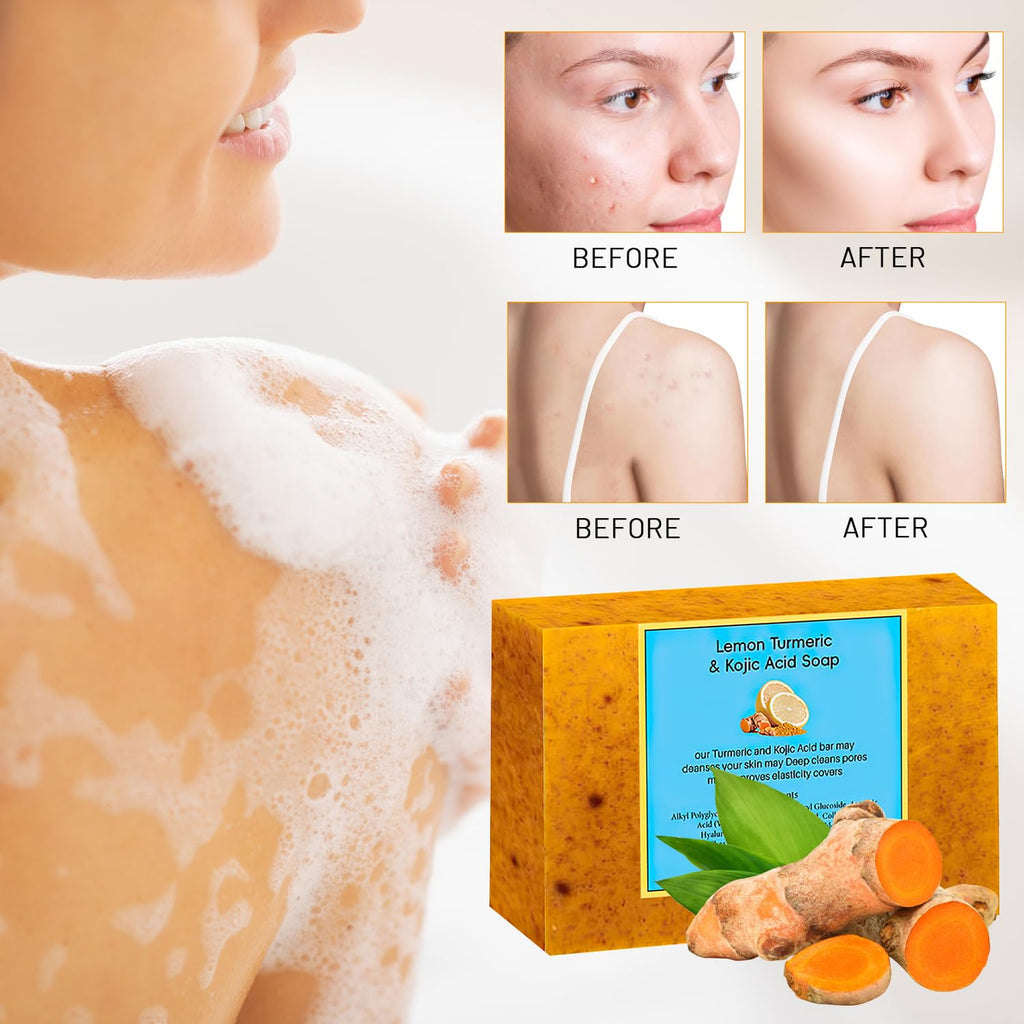 Nicgou Lemon Turmeric Kojic Soap - Turmeric Soap Bar for Face and Body, Natural Handmade Soaps Bar for All Skin Types, Daily Use Skin Care Deep Cleansing Moisturizing (2pcs)