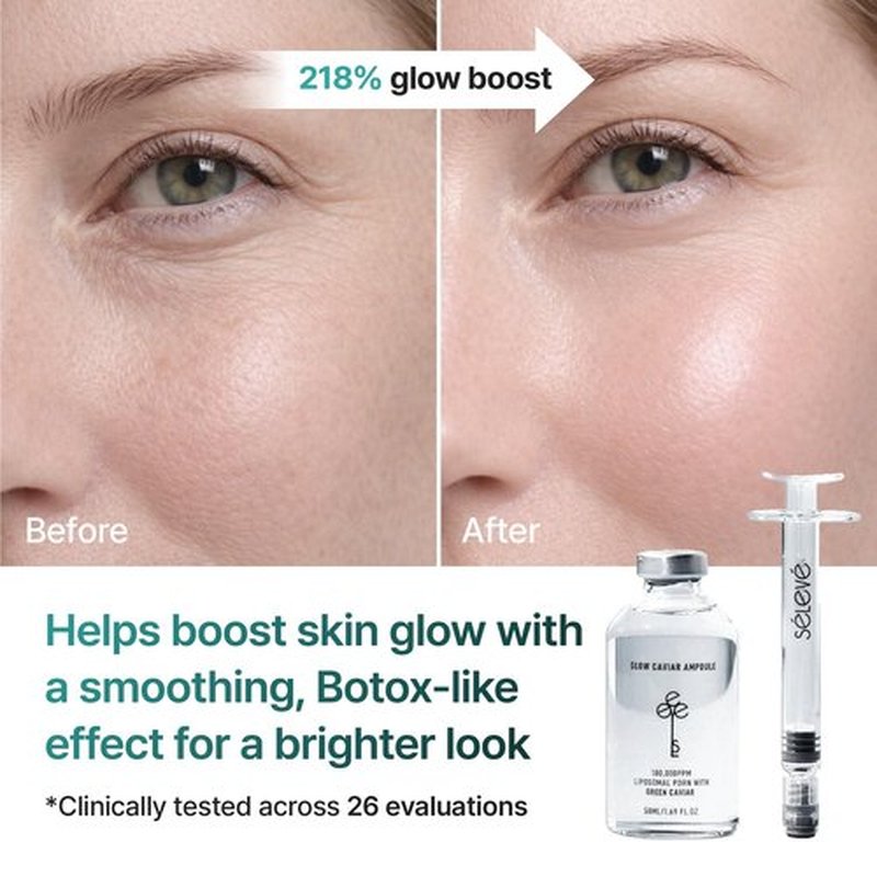 SELEVE Glow Caviar Ampoule – Intensive Hydration & Radiance Serum with Liposomal PDRN, Green Caviar Extract, Niacinamide & Ferulic Acid. Sensitive, Dry Skin, Korean Skincare (1.69 fl oz / 50 ml)