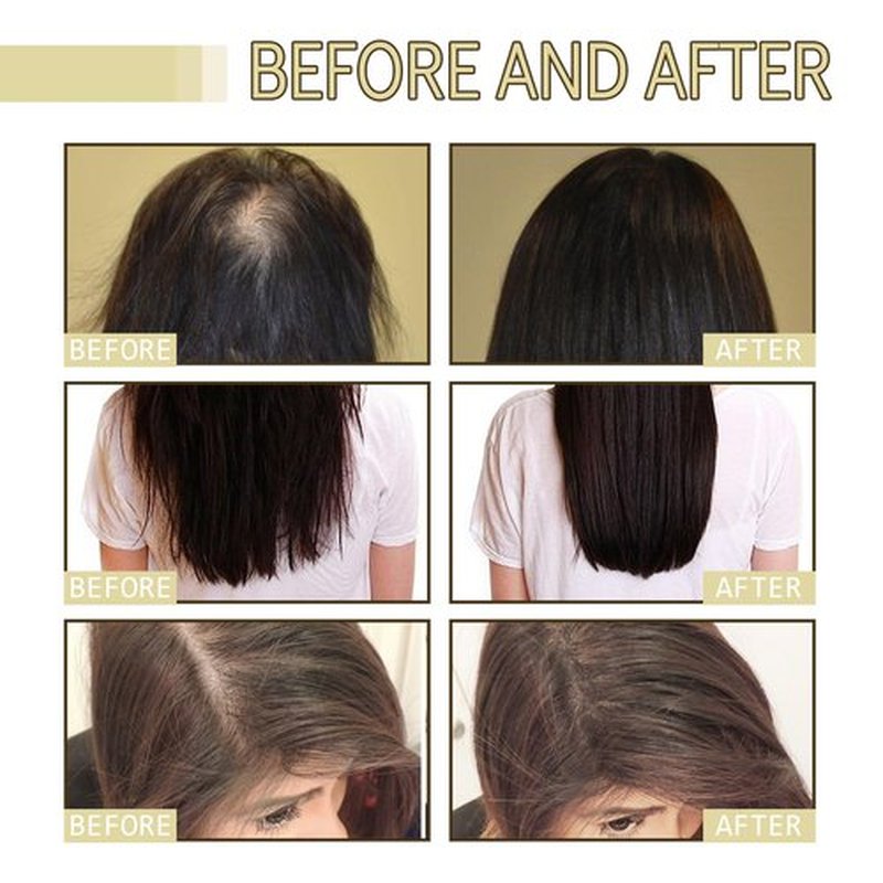 180 ML EELHOE Hair Growth Oil, Natural Rosemary Hair Growth Oil for Dry Damaged Hair and Growth Thin Hair. (3Pcs)