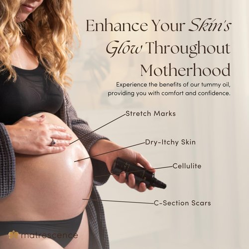 Matrescence Stretch Mark Relief Belly Oil - Hydrating Spa-Quality Maternity Treatment (3.4oz) | Pregnancy-Safe Non-Greasy Moisturizer for Moms