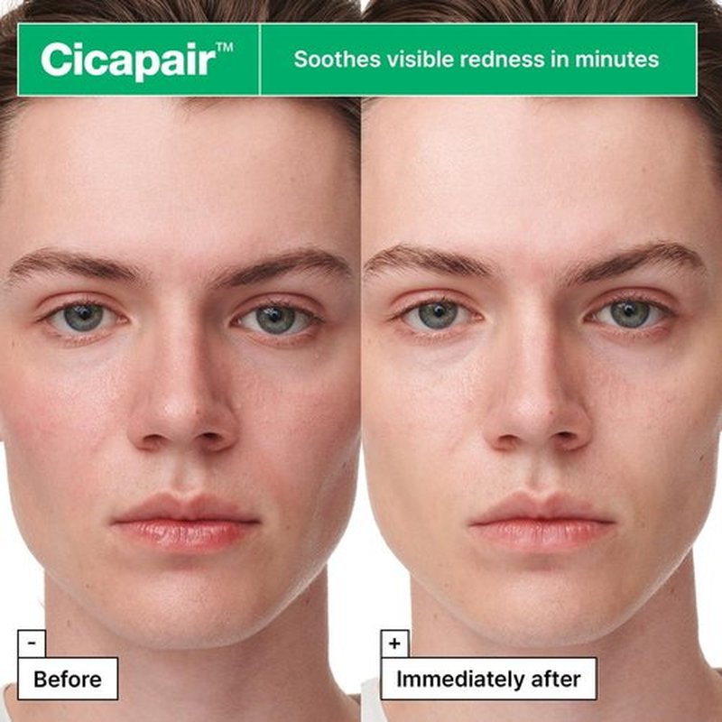 Dr.Jart+ Cicapair Serum - Soothing Face Mask for Redness Relief with Centella Asiatica | Korean Skin Care