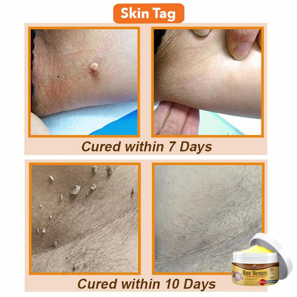 Gaukomzs 2PCS Bee Venom Cream, Visibly reduces skin blemishes and smoothes skin
