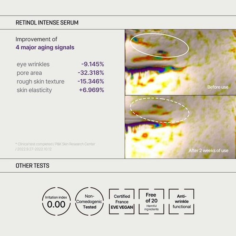 SOME BY MI Retinol Intense Trial Kit - Serum and Eye Cream, 0.33Oz - Mild Korean 0.1% Retinol Face Serum and Eye Cream for Beginner - Skin Texture, Elasticity and Under Eye Care - Korean Skin Care