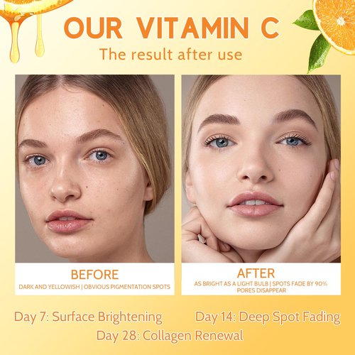 Premium 20% Vitamin C Serum for Face with Vitamin E, Sodium Hyaluronate - Boost Skin Collagen,Hydrate & Plump Skin, Anti Aging & Wrinkle Facial Serum (1 Fl Oz, Scented)