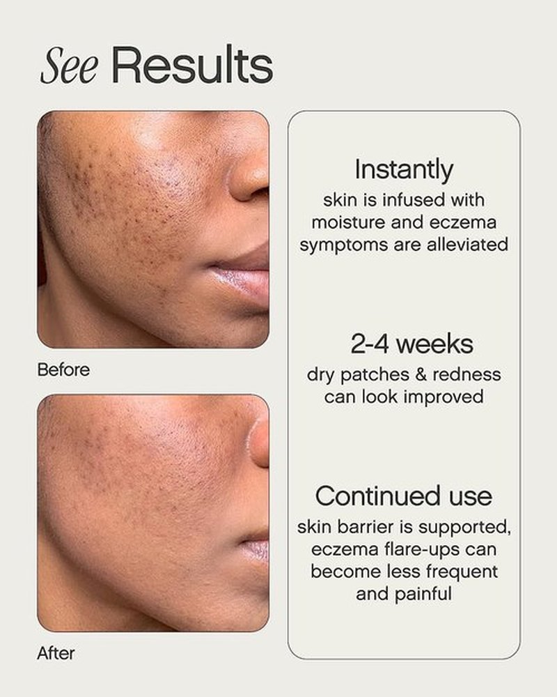 Topicals Like Butter Moisturizer - Soothing Relief for Dry, Sensitive & Eczema-Prone Skin | Hydrating Face & Body Cream (1.7 Fl Oz)