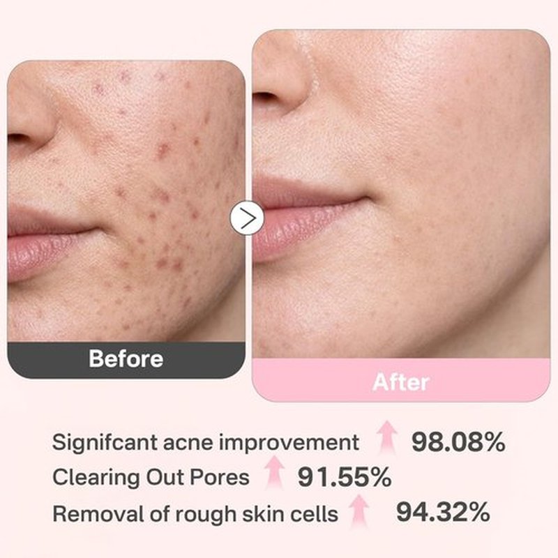 Glycolic Acid 20% Resurfacing Pads - Exfoliating Peel Pads for Radiant Skin | 50 Count with Salicylic Acid & Vitamins
