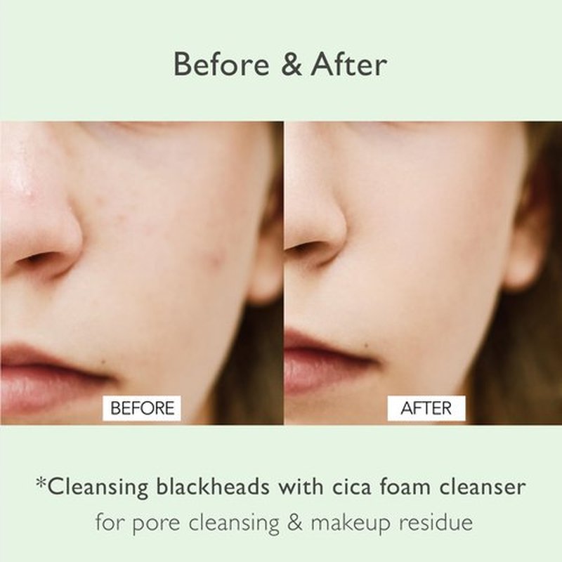 NOWATER Cica Pore Cleansing Foam | Pore Cleansing and Sebum Control | Cica, Hyaluronic Acid, Aloe | Daily Face Wash | Korean Skin Care for face (4.05 fl.oz)