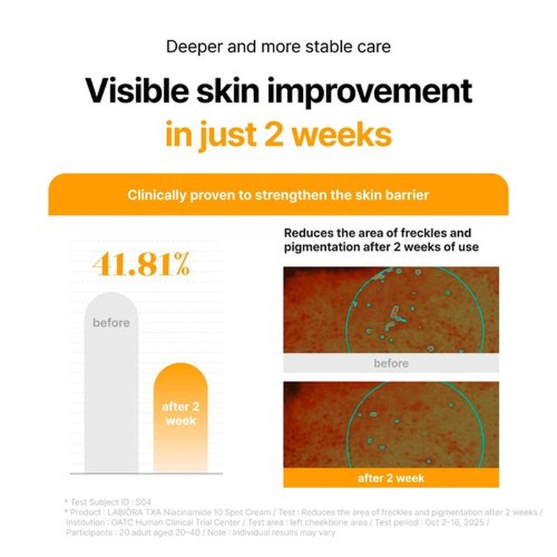 LABIORA CARE CREAM with TXA NIACINAMIDE for Uneven Skin Tone, Brightening & Radiance Support with Tranexamic Acid 6%, Niacinamide 4%, Glutathione & Arbutin, 0.67 fl oz