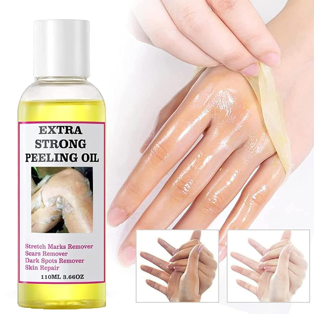 Generic Extra Strong Yellow Peeling Oil for Dark Skin - Exfoliating Solution for Body, Hand, Feet and Face - All Skin Types (110ML/3.88 Fl Oz)