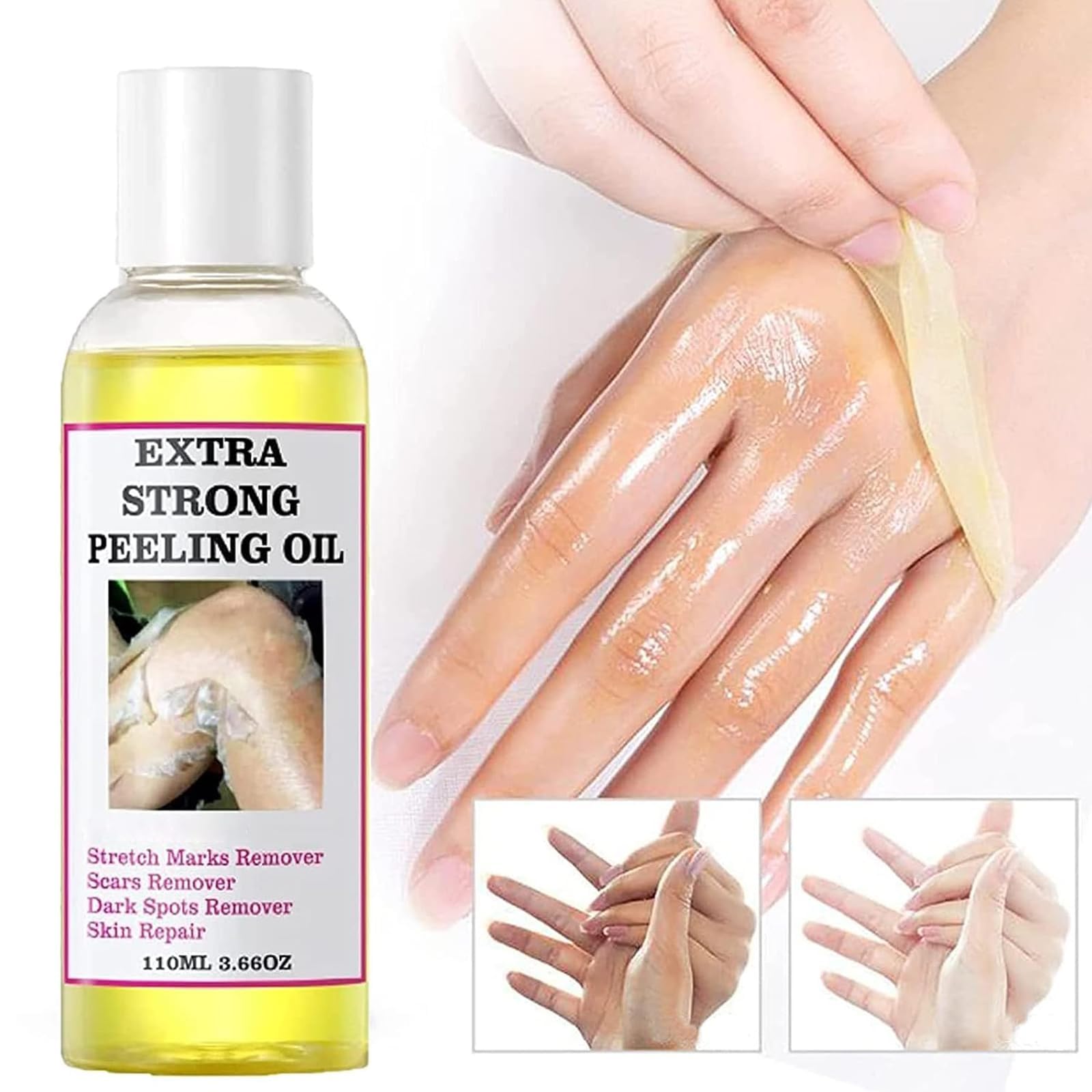 Generic Extra Strong Yellow Peeling Oil for Dark Skin - Exfoliating Solution for Body, Hand, Feet and Face - All Skin Types (110ML/3.88 Fl Oz)