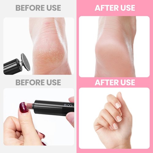 Electric Callus Remover for Feet, Electric Foot File Nail Grinder 2 in 1,Rechargeable Professional Foot Sander Pedicure Tool for Feet Dry Dead Skin with Sandpaper Disk, 9 Speed Adjustable (Black)