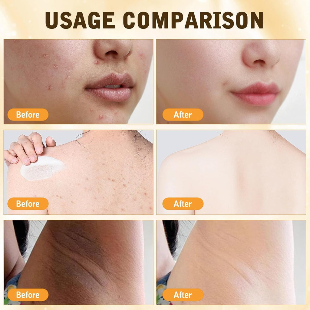 2PCS Bee Venom Skin Treatment Cream, New Bee Venom Comprehensive Cream for Body and Face, Natural Skin Moisturizer, Repairing and Moisturizing