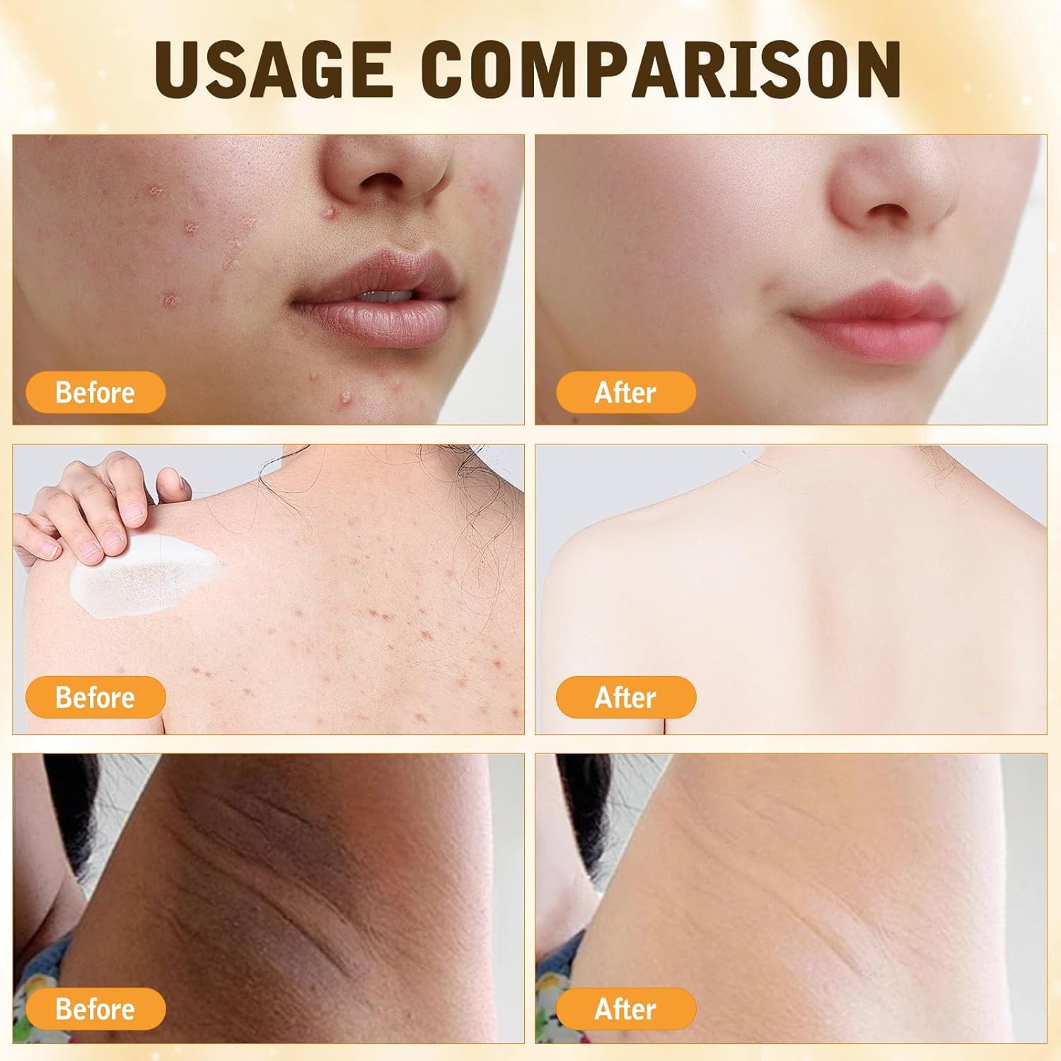 2PCS Bee Venom Skin Treatment Cream, New Bee Venom Comprehensive Cream for Body and Face, Natural Skin Moisturizer, Repairing and Moisturizing