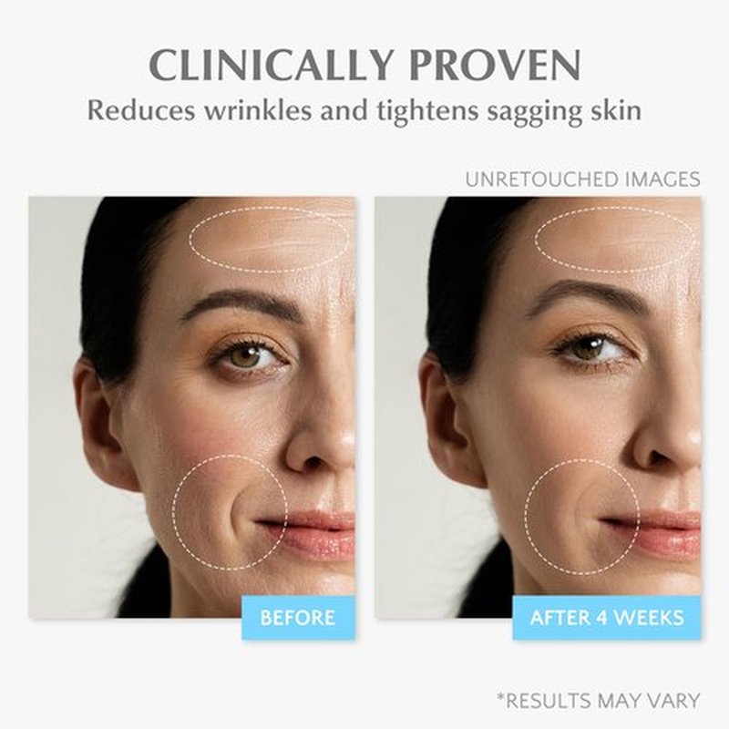 EnaSkin Retinol Collagen Face Cream: Wrinkle Cream for Women, Neck & Décolleté Anti Aging Moisturizer with 7% Hyaluronic Acid Serum - Day/Night Skin Firming & Tightening, 1.7 Oz