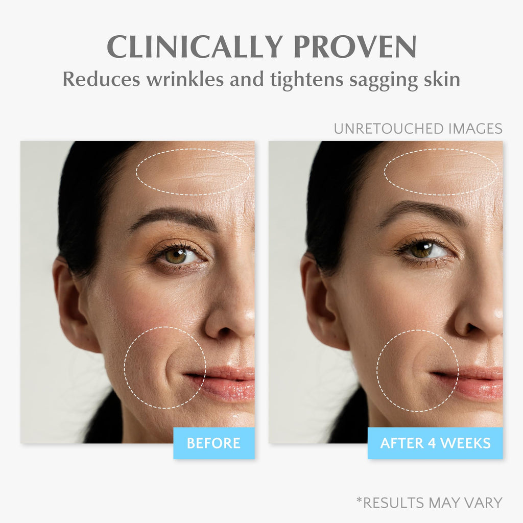 EnaSkin Retinol Collagen Face Cream: Wrinkle Cream for Women, Neck & Décolleté Anti Aging Moisturizer with 7% Hyaluronic Acid Serum - Day/Night Skin Firming & Tightening, 1.7 Oz