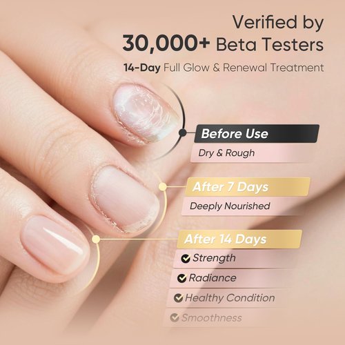 Cuticle Oil for Dry Cuticles – Pacfe Velour Rosa Nail & Cuticle Oil with Jojoba Oil, Squalane & Vitamin E, Rose Scented Care for Brittle Nails, 30ml Large Size