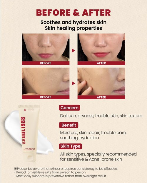 K-SECRET SEOUL 1988 Snail Mucin 93% Cream – Concentrated Yet Lightweight Formula Infused with 93% Snail Mucin | Non-Sticky & Fast-Absorption Facial Cream | Korean Skincare, 100ml / 3.38 fl oz