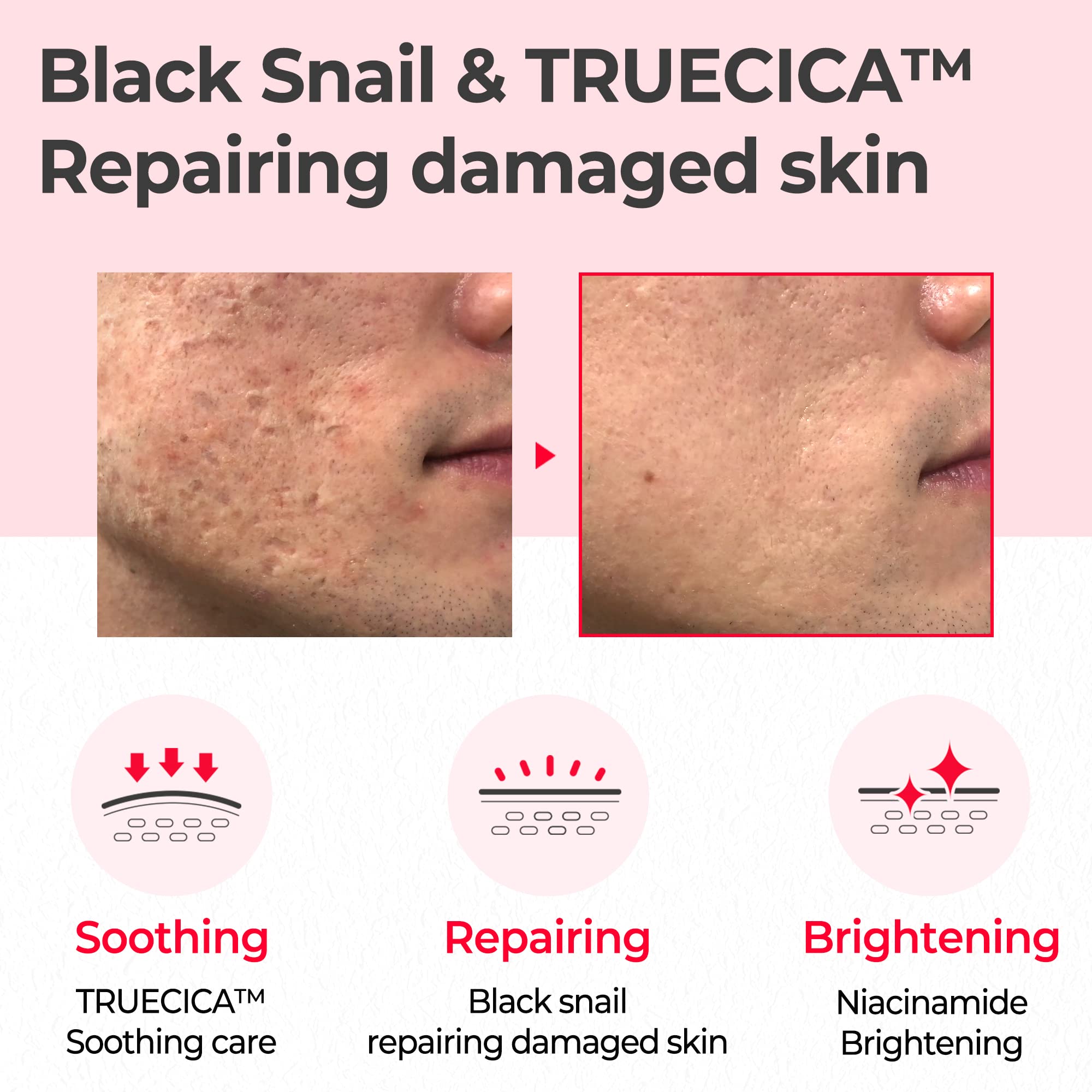 SOME BY MI Snail Truecica Miracle Repair Toner - 4.6Oz, 135ml - Made from Snail Mucin for Sensitive Skin - Daily Repair Face Toner with Skin Texture and Pigmentation Care - Korean Skin Care