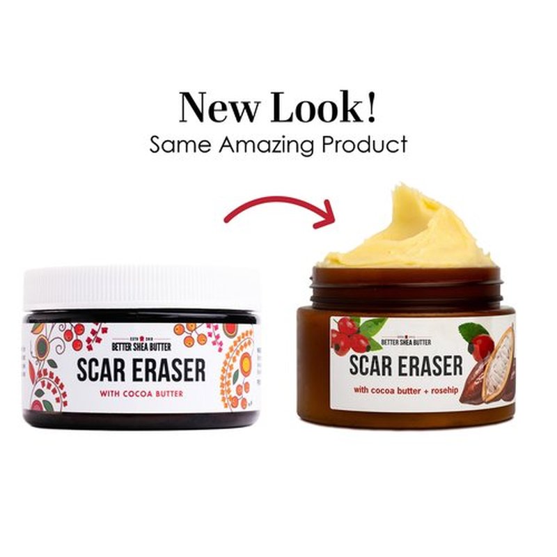 Better Shea Butter Scar Eraser Balm - Cocoa Butter Cream for Stretch Marks and Dark Spots, Burns, Old Scars - Acne Scars - Designed w Zero Synthetic Ingredients, 4 oz