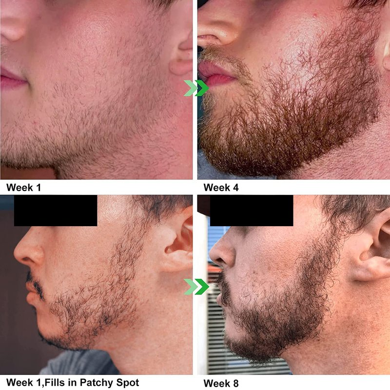 Unscented Beard Oil - Natural Hydrating & Conditioning Blend for Facial Hair - 32 oz | Promotes Growth & Silky Smoothness - Jojoba & Argan