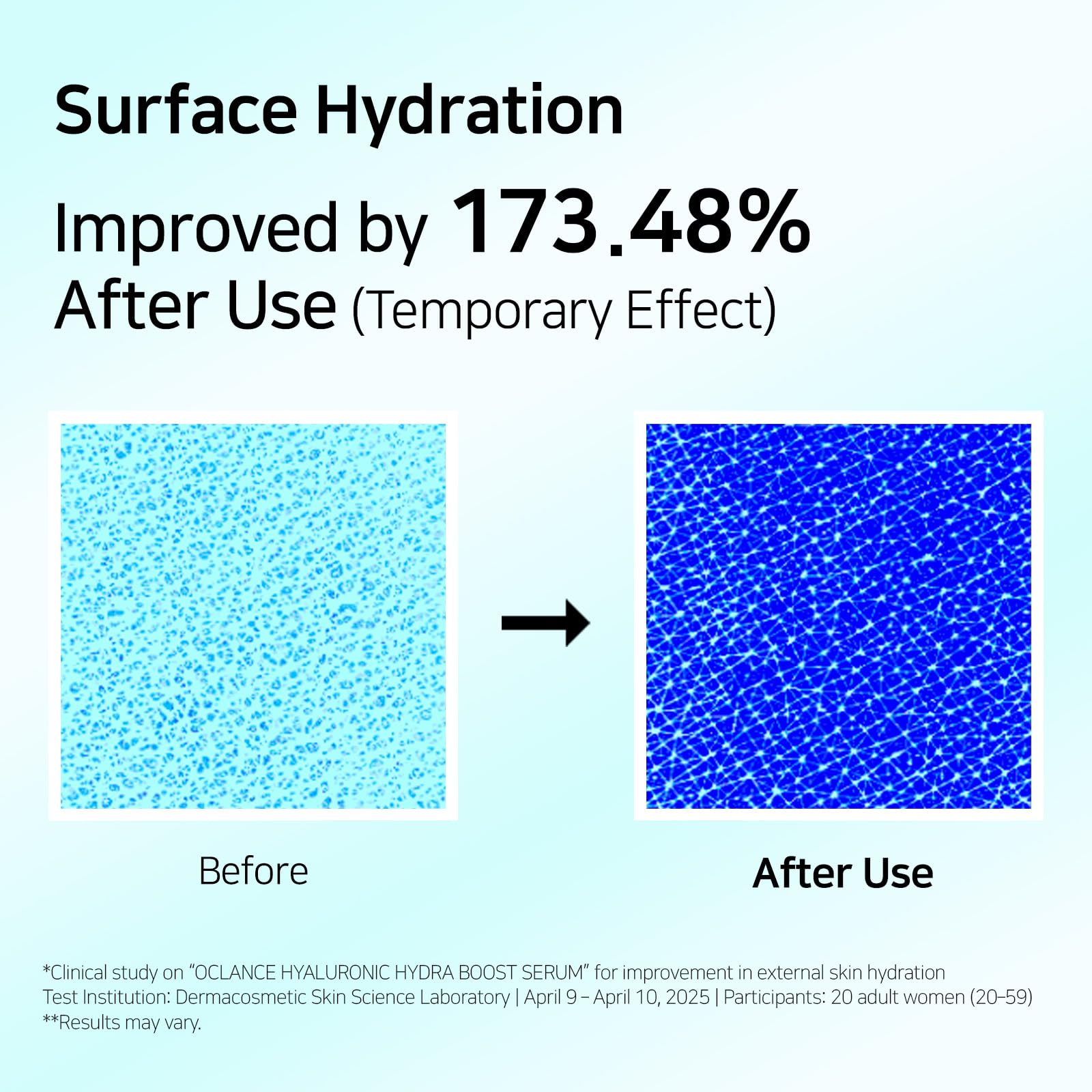 OCLANCE Hyaluronic Hydra Boost Serum with 10 Multi Hyaluronic Acid, Niacinamide, Panthenol | Lightweight, Hydrating for Glowing Skin | Non-Greasy, Fragrance-Free, Korean Skincare | 50ml / 1.69 fl. oz