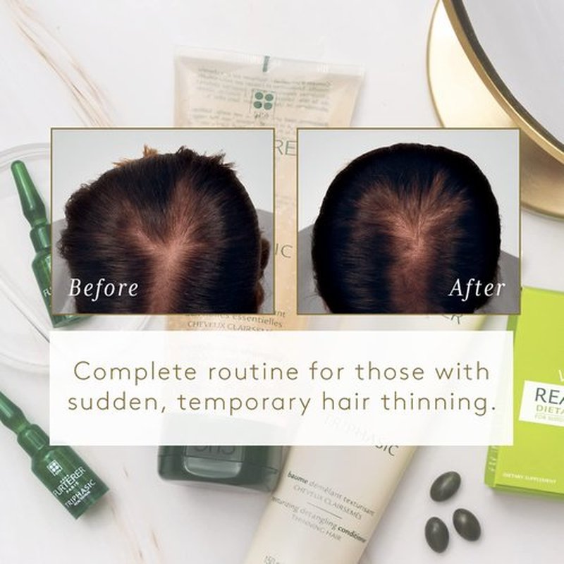 Rene Furterer Reactional Thinning Hair Ritual - Drug-Free Solution for Sudden Thinning Hair - 1 Ct.