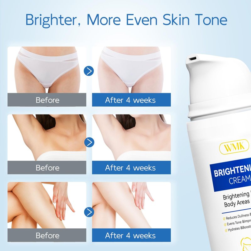WMK Skin Bleaching Cream for Intimate Areas – Vitamin C Dark Spot Remover for Underarms, Knees, Elbows & Bikini Line